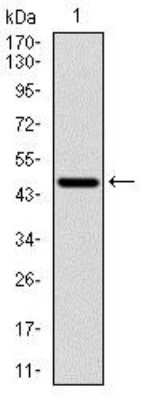 Western Blot: p70 S6 Kinase/S6K Antibody (5G9)BSA Free [NBP2-22205]