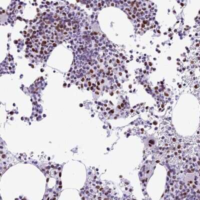 Immunohistochemistry: p70 S6 Kinase/S6K Antibody [NBP2-38448]