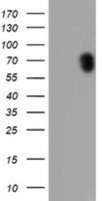 Western Blot: p70 S6 Kinase/S6K Antibody (OTI1G4)Azide and BSA Free [NBP2-73209]