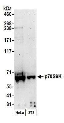 Western Blot: p70 S6 Kinase/S6K Antibody [NB100-293]