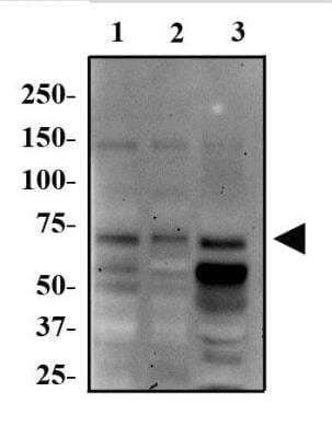 Western Blot: p70 S6 Kinase/S6K Antibody [NBP2-23649]