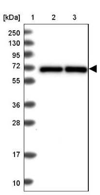 Western Blot: p70 S6 Kinase/S6K Antibody [NBP2-38448]