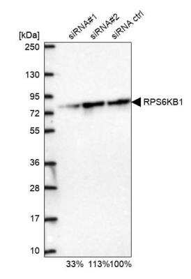 Western Blot: p70 S6 Kinase/S6K Antibody [NBP2-38448]