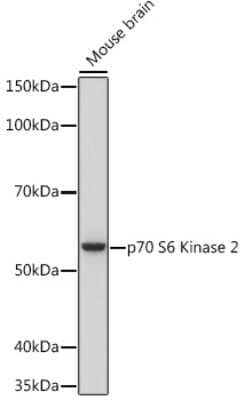 Western Blot: p70 S6 Kinase beta/S6K2 Antibody (5D8F5) [NBP3-16752]