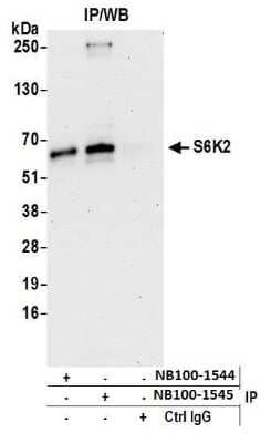 Immunoprecipitation: p70 S6 Kinase beta/S6K2 Antibody [NB100-1544]