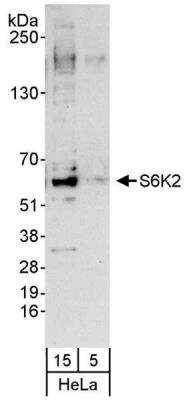 Western Blot: p70 S6 Kinase beta/S6K2 Antibody [NB100-1545]