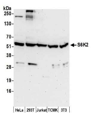 Western Blot: p70 S6 Kinase beta/S6K2 Antibody [NB100-1545]