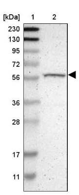 Western Blot: p70 S6 Kinase beta/S6K2 Antibody [NBP1-87805]
