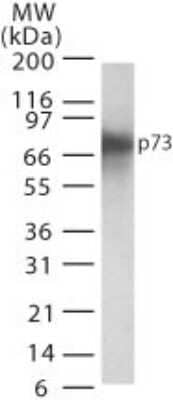 Western Blot: p73 Antibody (5B1288)Azide Free [NBP2-33241]