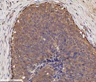 Immunohistochemistry-Paraffin: p73 Antibody (5B1288) - BSA Free [NB100-56674]