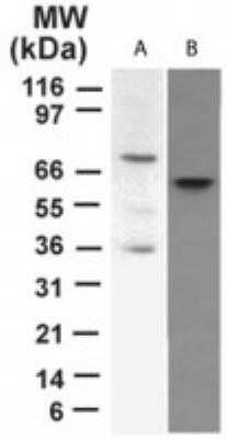 Western Blot: p73 Antibody (5B429)Azide Free [NBP2-33259]