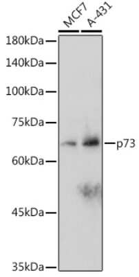 Western Blot: p73 Antibody (7L1V7) [NBP3-16142]