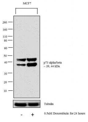 Western Blot: p73 Antibody (ER-15) [NB600-1279]