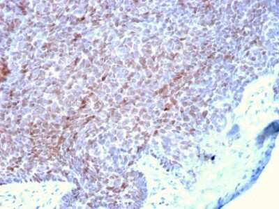 Immunohistochemistry-Paraffin: p73 Antibody (P73/2531) - Azide and BSA Free [NBP3-08760]