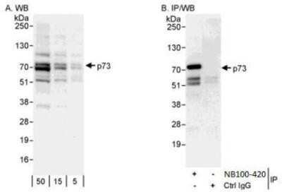 Western Blot: p73 Antibody [NB100-420]