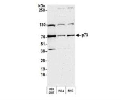 Western Blot: p73 Antibody [NB100-420]