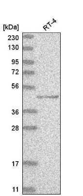 Western Blot: p73 Antibody [NBP2-58335]