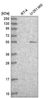 Western Blot: p73 Antibody [NBP2-58523]