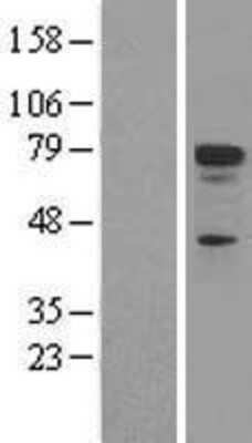 Western Blot: p73 Overexpression Lysate [NBL1-17209]