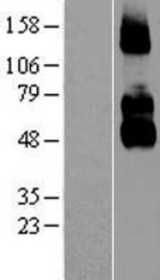 Western Blot: NGFR/TNFRSF16/p75NTR Overexpression Lysate [NBL1-13635]