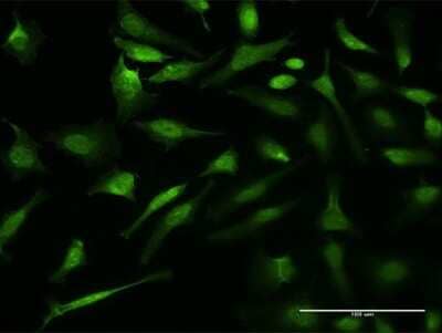 Immunocytochemistry/ Immunofluorescence: p97/VCP Antibody (2H5) [H00007415-M15]