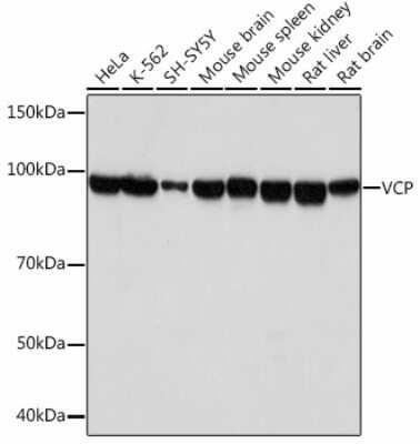 Western Blot: p97/VCP Antibody (3P8T3) [NBP3-15478]