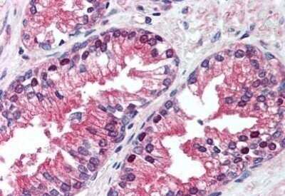 Immunohistochemistry-Paraffin: p97/VCP Antibody (4G9) - BSA Free [NBP1-39850]