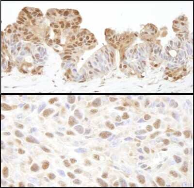 Immunohistochemistry-Paraffin: p97/VCP Antibody [NB100-1557]