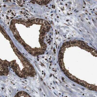 Immunohistochemistry-Paraffin: p97/VCP Antibody [NBP1-81619]
