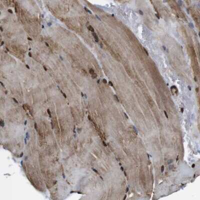 Immunohistochemistry-Paraffin: p97/VCP Antibody [NBP1-81619]