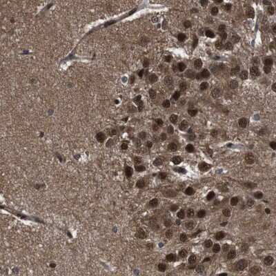 Immunohistochemistry-Paraffin: p97/VCP Antibody [NBP1-81620]