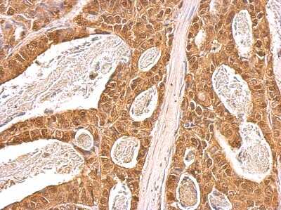 Immunohistochemistry-Paraffin: p97/VCP Antibody [NBP2-15162]