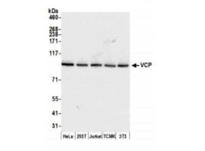 Western Blot: p97/VCP Antibody [NB100-1558]