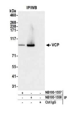 Western Blot: p97/VCP Antibody [NB100-1558]