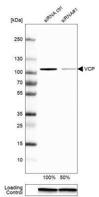 Western Blot: p97/VCP Antibody [NBP1-81619]