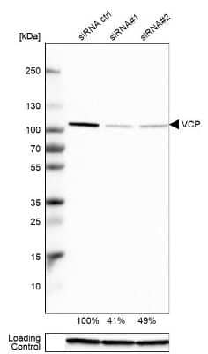 Western Blot: p97/VCP Antibody [NBP1-81620]