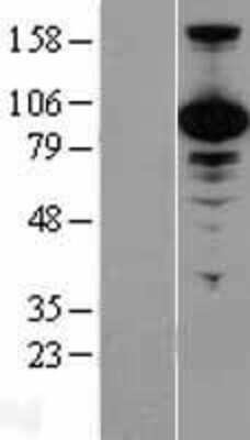 Western Blot: p97/VCP Overexpression Lysate [NBL1-17707]