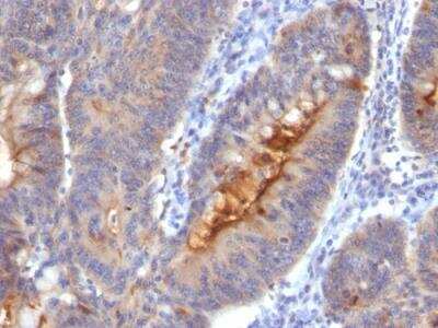 Immunohistochemistry-Paraffin: ECM-1/Secretory Component P85 Antibody (SC05) - IHC-Prediluted [NBP3-05763]