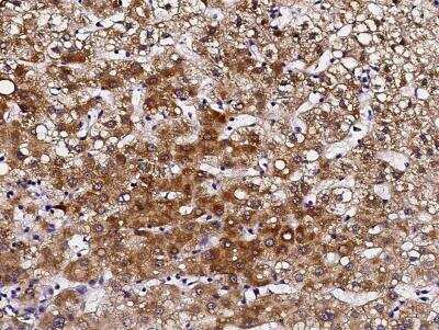 Immunohistochemistry-Paraffin: pIgR Antibody (007) [NBP2-89286]