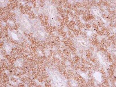 Immunohistochemistry-Paraffin: pIgR Antibody [NBP1-32897]