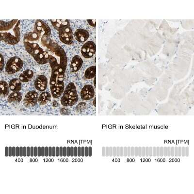 Immunohistochemistry-Paraffin: pIgR Antibody [NBP1-86095]