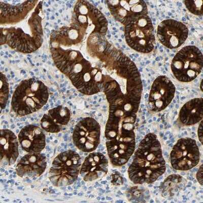 Immunohistochemistry-Paraffin: pIgR Antibody [NBP1-86095]