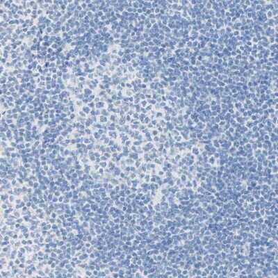 Immunohistochemistry-Paraffin: pIgR Antibody [NBP1-86095]
