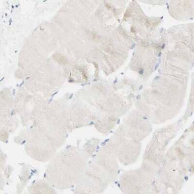 Immunohistochemistry-Paraffin: pIgR Antibody [NBP1-86095]
