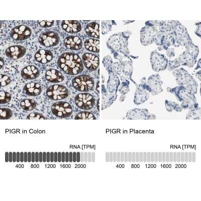 Immunohistochemistry-Paraffin: pIgR Antibody [NBP1-86504]