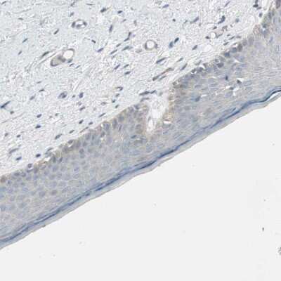 Immunohistochemistry-Paraffin: pIgR Antibody [NBP1-86504]