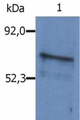 Western Blot: BLNK Antibody [NB500-542]