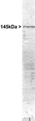 Western Blot: NF-M Antibody [NB300-133]