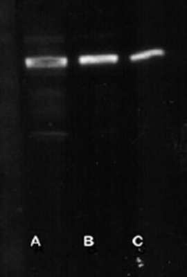 Western Blot: Parkin Antibody [NB600-1540]