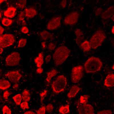 Immunohistochemistry: ACCN1 Antibody - BSA Free [NB100-2531]